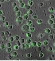 Leukaemia stem cells have high expression of NF-KB (green). These cells can be targeted using inhibitors of this transcription factor.
